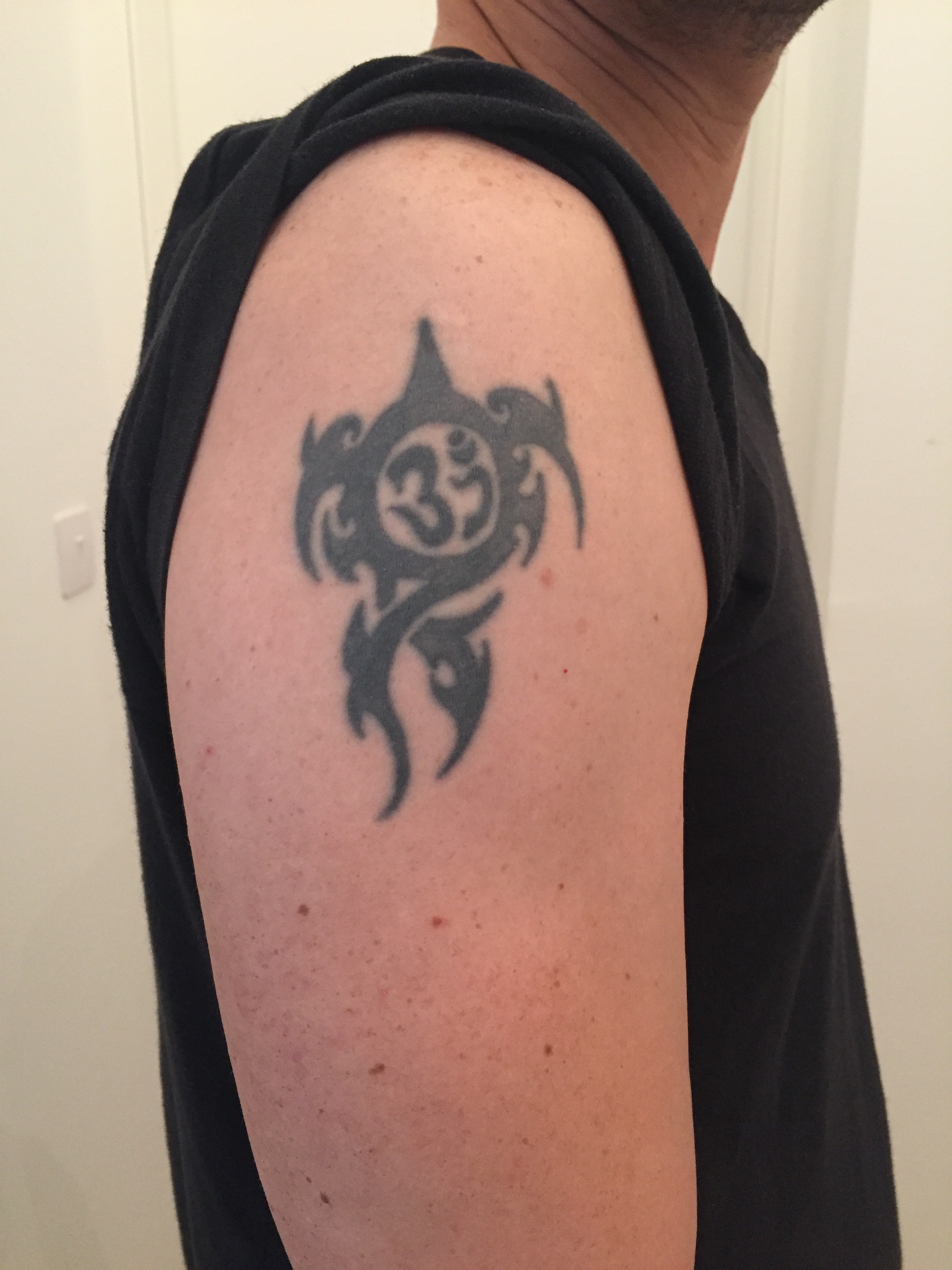 Laser tattoo removal before and after result 9